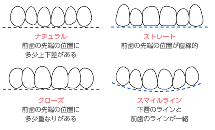 セラミック